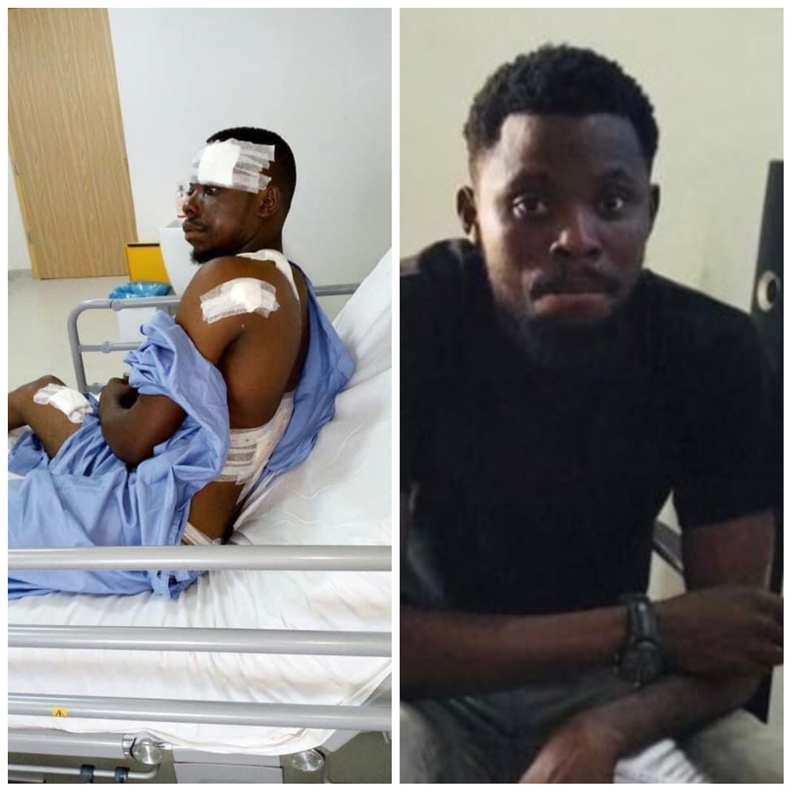 Miraculous Survival: Nigerian Man, Ekanem, Commemorates 7th Anniversary of Harrowing Armed Robbery Attack