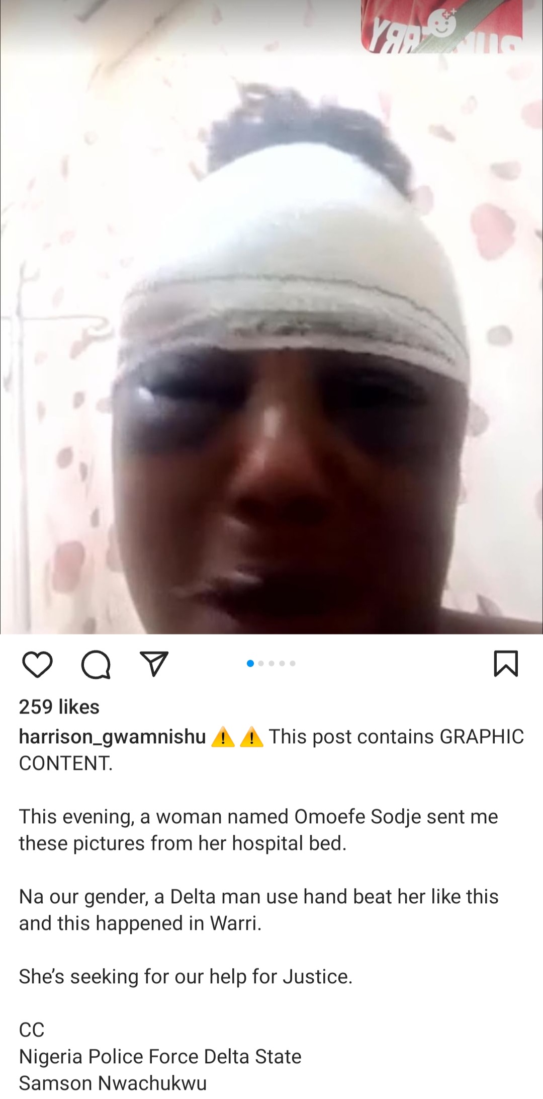 Brutal Assault Leaves Woman Hospitalized with Severe Injuries in Warri, Delta State"